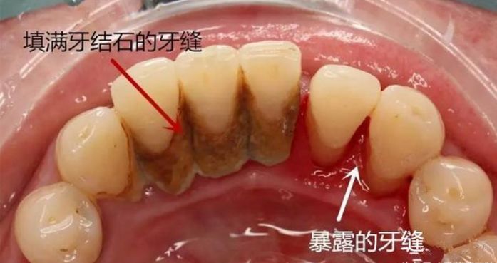 屌丝创业冰瓷牙是{zh0}的选择