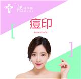 膚詩華娜祛斑產品價格-源頭淡斑
