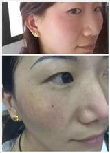 膚詩華娜祛斑多少錢