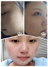 膚詩華娜是功效產品嗎