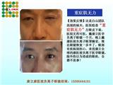 康立康醫(yī)視防輻射眼鏡加盟需要多少錢