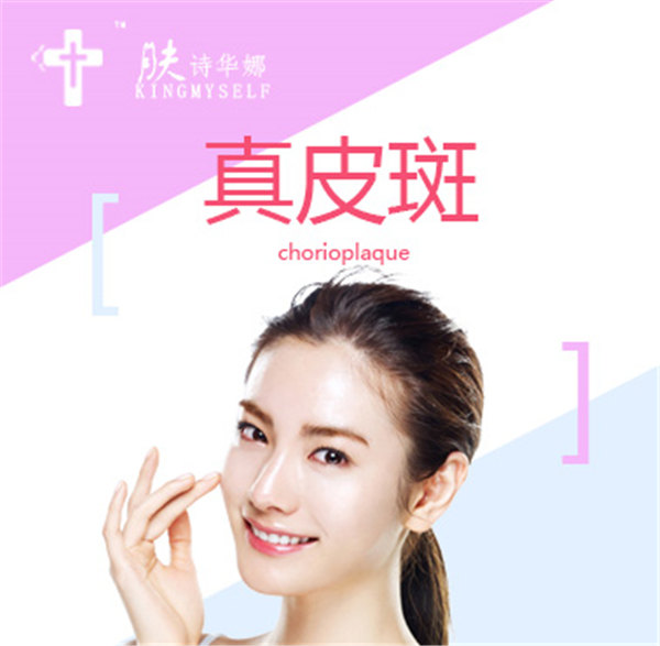 膚詩(shī)華娜祛斑產(chǎn)品好不好