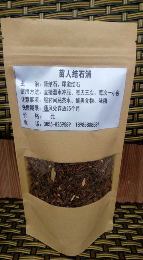 膽囊里結(jié)石zl方法 常見胃病怎么治 黔東南苗德堂生物科技有限